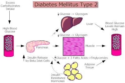 Diabetes Mellitus Type 2