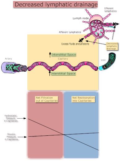 Decreased Lymphatic Drainage
