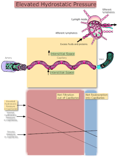 Elevated Hydrostatic Pressure